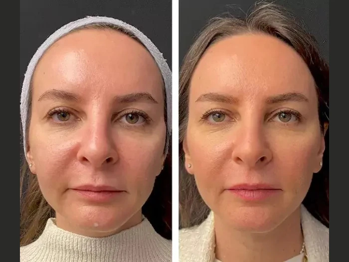 Best Plastic Surgeons in Dubai for Hair Mesotherapy Solutions