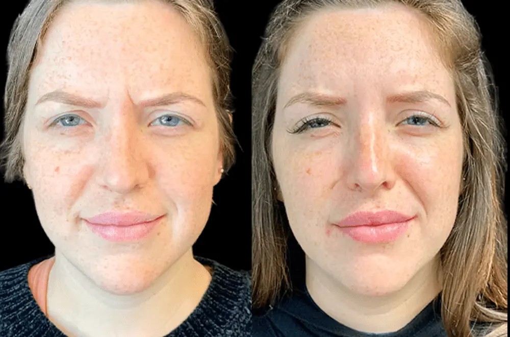 Popular Non-Surgical Treatments at the Best Aesthetic Clinic in Dubai