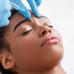 Anti-Wrinkle Treatments in London